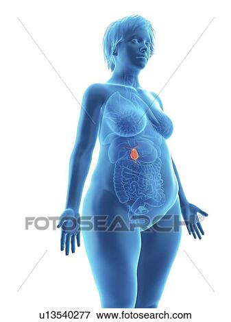 Stock Photo - Illustration of an obese woman's gallbladder.. Fotosearch