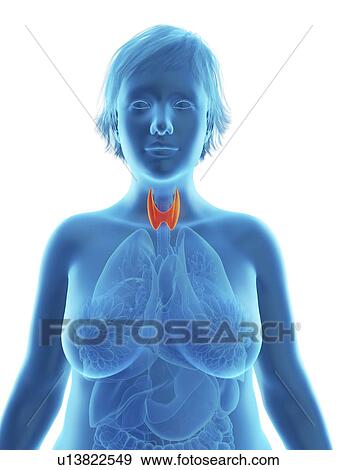Stock Photo - Illustration of an obese woman's thyroid gland.. Fotosearch