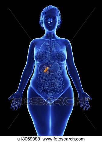 Illustration of an obese woman's gallbladder. View Large Photo Image Stock Photo - Illustration of an obese woman's gallbladder.. Fotosearch