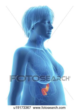 Stock Photo - Illustration of an obese woman's pancreas.. Fotosearch