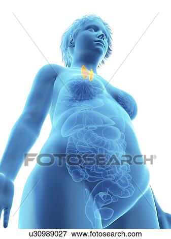 Stock Photo - Illustration of an obese woman's thyroid gland.. Fotosearch