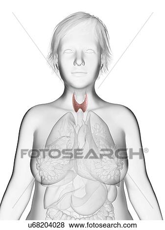 Stock Photo - Illustration of an obese woman's thyroid gland.. Fotosearch