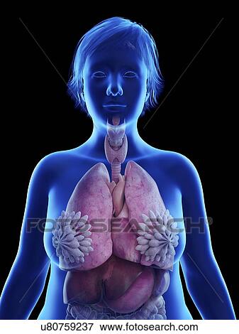 Illustration of an obese woman's internal organs. View Large Photo Image Stock Photo - Illustration of an obese woman's internal organs.. Fotosearch