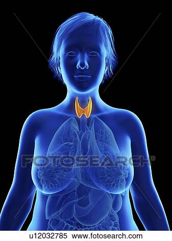 Stock Photography - Illustration of an obese woman's thyroid gland.. Fotosearch