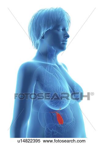 Stock Photography - Illustration of an obese woman's gallbladder.. Fotosearch