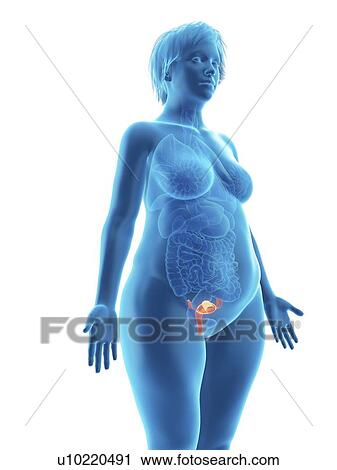 Stock Image - Illustration of an obese woman's uterus.. Fotosearch