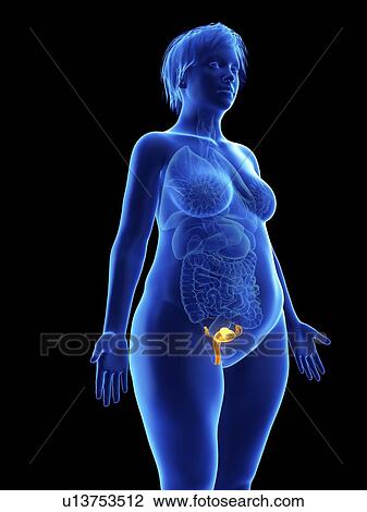 Stock Image - Illustration of an obese woman's uterus.. Fotosearch