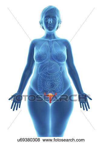 Stock Photo - Illustration of an obese woman's uterus.. Fotosearch