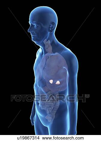 Picture - Illustration of an old man's adrenal glands.. Fotosearch