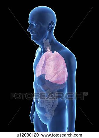 Stock Image - Illustration of an old man's lung.. Fotosearch