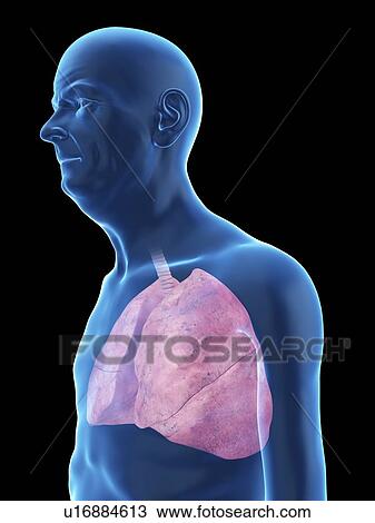 Stock Image - Illustration of an old man's lung.. Fotosearch