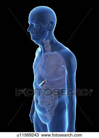 Stock Image - Illustration of an old man's gallbladder.. Fotosearch