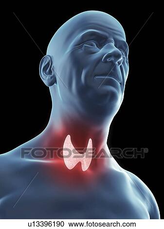 Illustration of an old man's thyroid gland. View Large Photo Image Stock Image - Illustration of an old man's thyroid gland.. Fotosearch