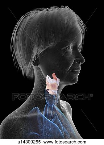 Stock Photography - Illustration of an old woman's larynx.. Fotosearch