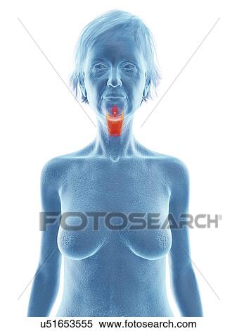 Stock Photography - Illustration of an old woman's larynx.. Fotosearch