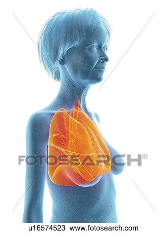 Stock Image - Illustration of an old woman's lung.. Fotosearch
