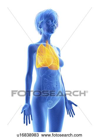 Stock Image - Illustration of an old woman's lung.. Fotosearch