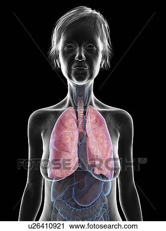 Stock Image - Illustration of an old woman's lung.. Fotosearch