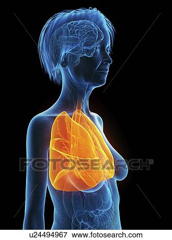 Stock Photo - Illustration of an old woman's lung.. Fotosearch