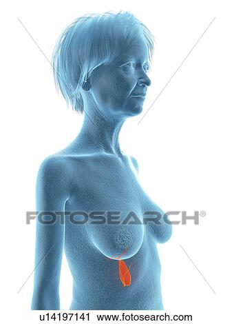Stock Image - Illustration of an old woman's gallbladder.. Fotosearch