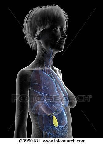 Stock Image - Illustration of an old woman's gallbladder.. Fotosearch