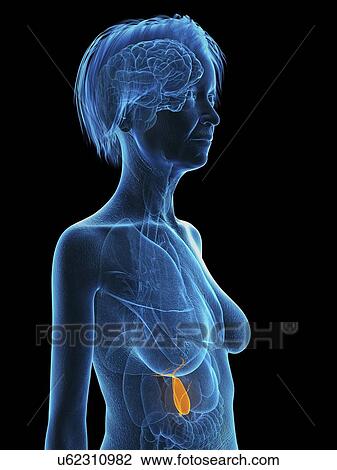 Stock Image - Illustration of an old woman's gallbladder.. Fotosearch