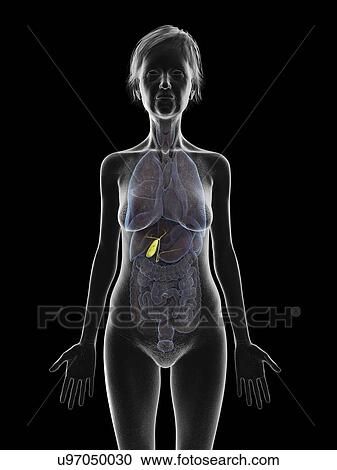Stock Image - Illustration of an old woman's gallbladder.. Fotosearch