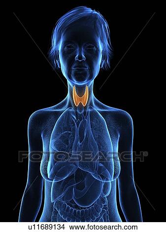 Picture - Illustration of an old woman's thyroid gland.. Fotosearch