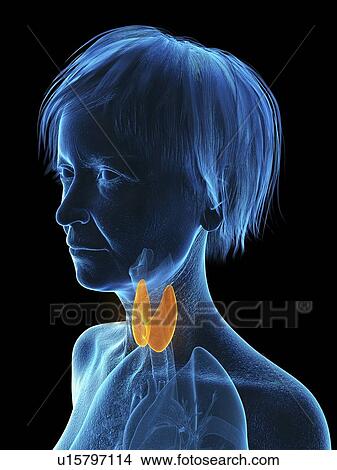 Picture - Illustration of an old woman's thyroid.. Fotosearch