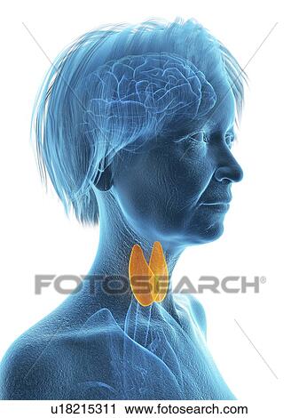 Stock Image - Illustration of an old woman's thyroid gland.. Fotosearch