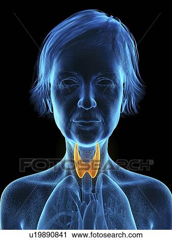 Stock Image - Illustration of an old woman's thyroid gland.. Fotosearch