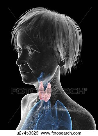 Stock Image - Illustration of an old woman's thyroid.. Fotosearch