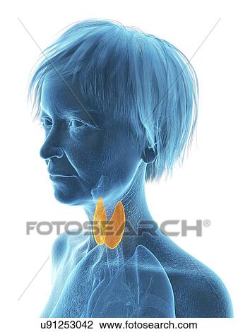 Stock Image - Illustration of an old woman's thyroid gland.. Fotosearch