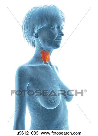Stock Image - Illustration of an old woman's thyroid gland.. Fotosearch