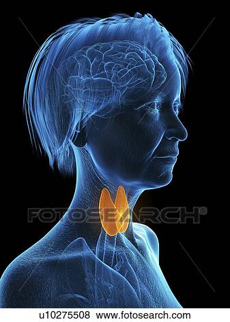 Stock Photo - Illustration of an old woman's thyroid gland.. Fotosearch
