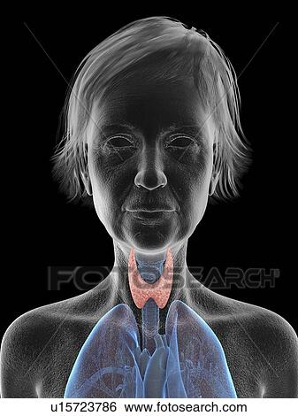 Stock Photograph - Illustration of an old woman's thyroid.. Fotosearch