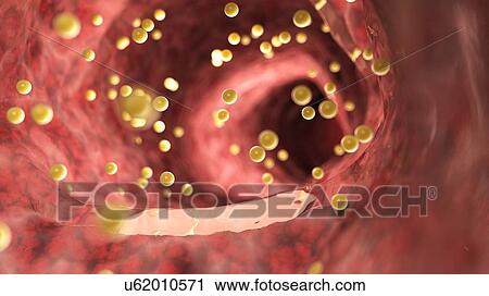 Illustration of gluten inside the colon. View Large Photo Image Stock Image - Illustration of gluten inside the colon.. Fotosearch