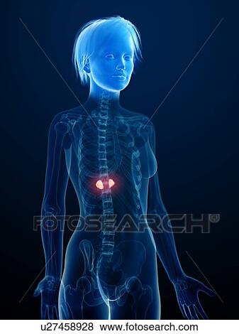 Stock Photo - Illustration of inflamed adrenal glands.. Fotosearch