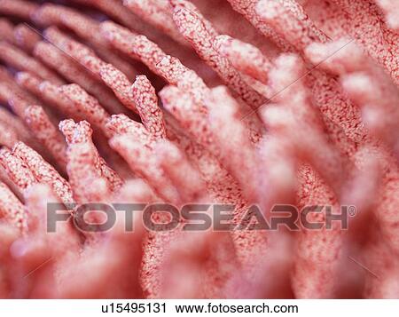Illustration of inflamed intestinal villi. View Large Photo Image Stock Image - Illustration of inflamed intestinal villi.. Fotosearch