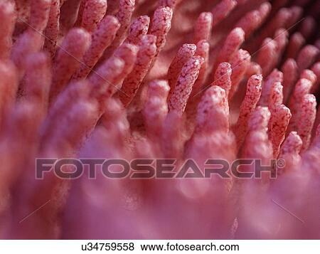 Stock Photo - Illustration of inflamed intestinal villi.. Fotosearch