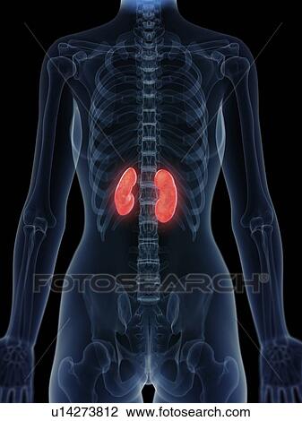 Stock Image - Illustration of inflamed kidneys.. Fotosearch