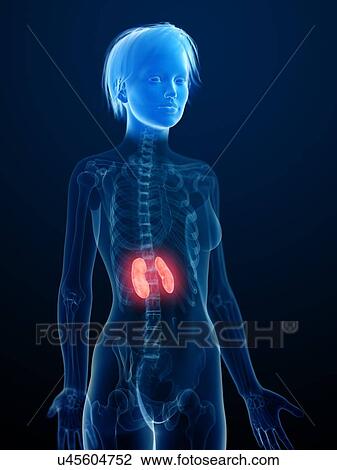 Stock Image - Illustration of inflamed kidneys.. Fotosearch