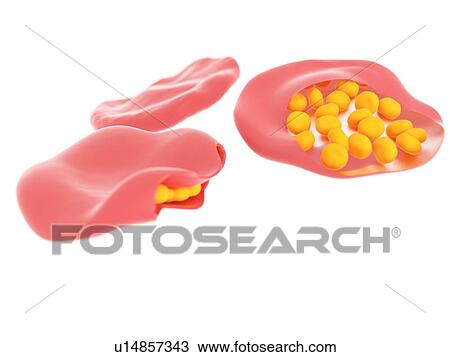 Illustration of malaria infected blood cells. View Large Photo Image Stock Image - Illustration of malaria infected blood cells.. Fotosearch
