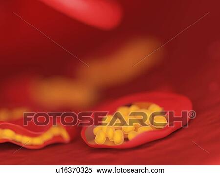 Stock Photography - Illustration of malaria infected blood cells.. Fotosearch