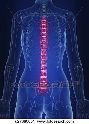 Stock Image - Illustration of painful back.. Fotosearch
