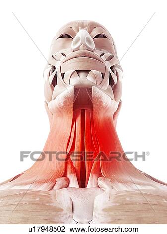 Illustration of painful neck muscles. View Large Photo Image Stock Image - Illustration of painful neck muscles.. Fotosearch