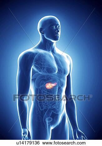 Illustration of pancreas cancer. View Large Photo Image Stock Photograph - Illustration of pancreas cancer.. Fotosearch