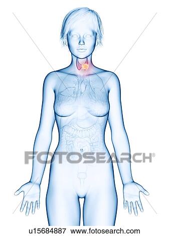Illustration of thyroid gland cancer. View Large Photo Image Stock Photo - Illustration of thyroid gland cancer.. Fotosearch