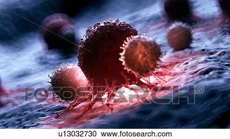 Stock Image - Illustration of white blood cells attacking a cancer cell.. Fotosearch