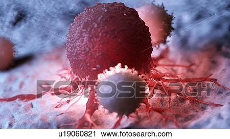 Stock Image - Illustration of white blood cells attacking a cancer cell.. Fotosearch